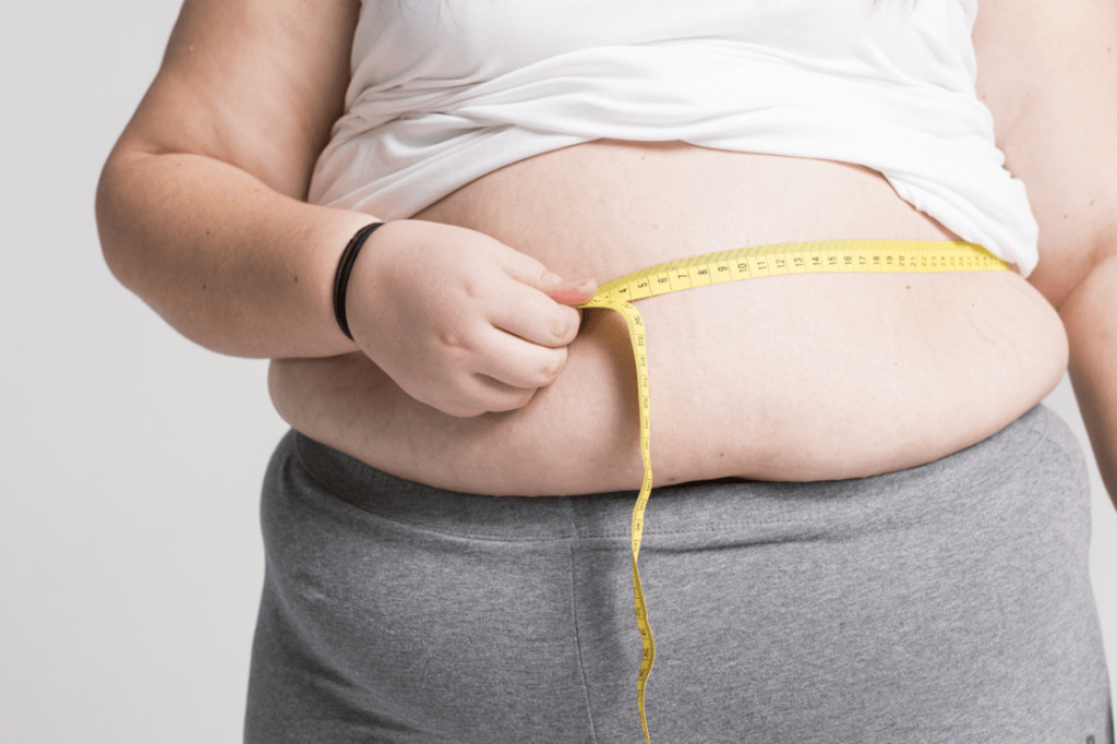 Can I afford Weight Loss surgery in South Florida?