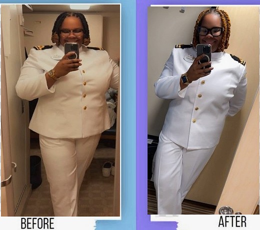 Before and after weight loss transformation with physician supervision in Florida