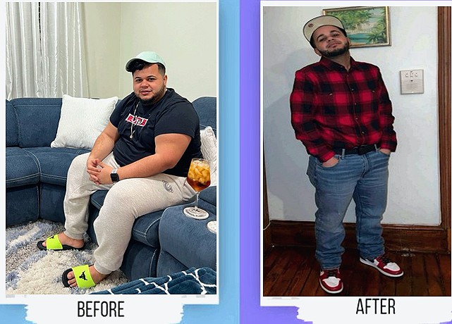 Before and after medical weight loss patient result in Florida