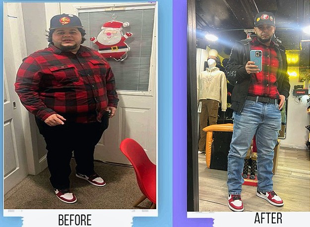 Before and after weight management result with Dr. Sergey Terushkin