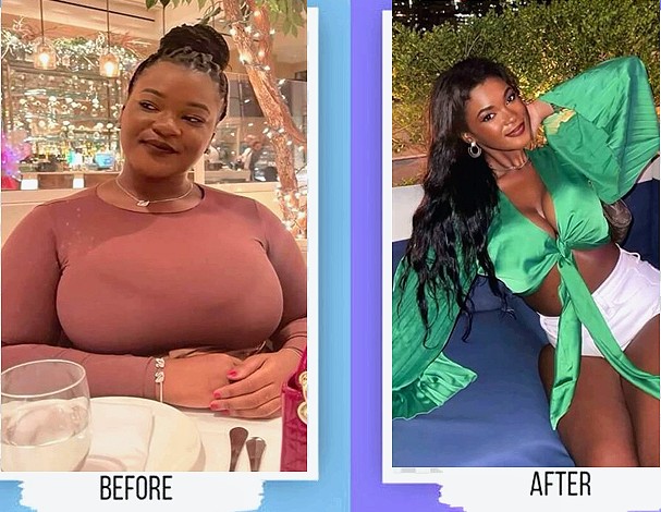 Weight loss before and after transformation from a real Florida patient