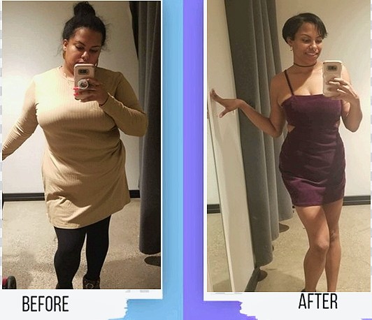 Real patient before and after weight loss transformation in Florida