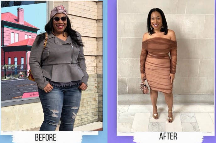 tirzepatide after gastric sleeve Before and After Gallery: Real Results from Weight Loss Injections or  Bariatric Surgery