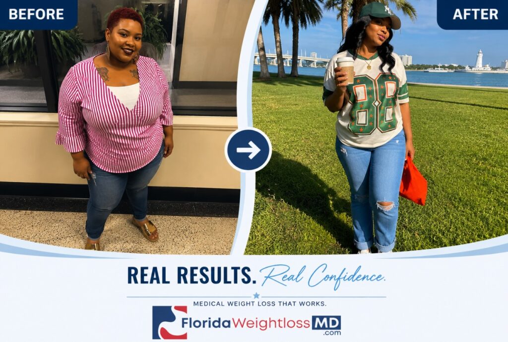 Before and after weight loss transformation of a patient treated at Florida Surgery and Weight Loss Center through a physician-supervised medical weight loss program.