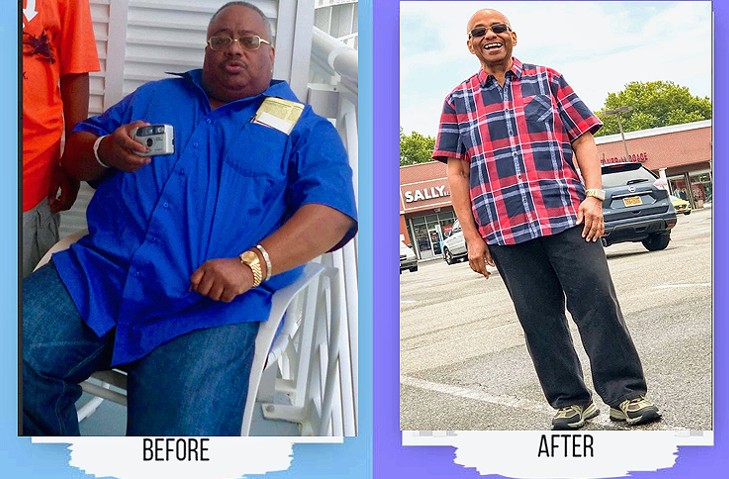 Before and after weight loss results with Dr. Sergey Terushkin