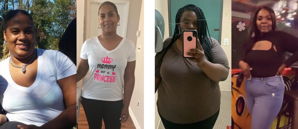 mounjaro before and after