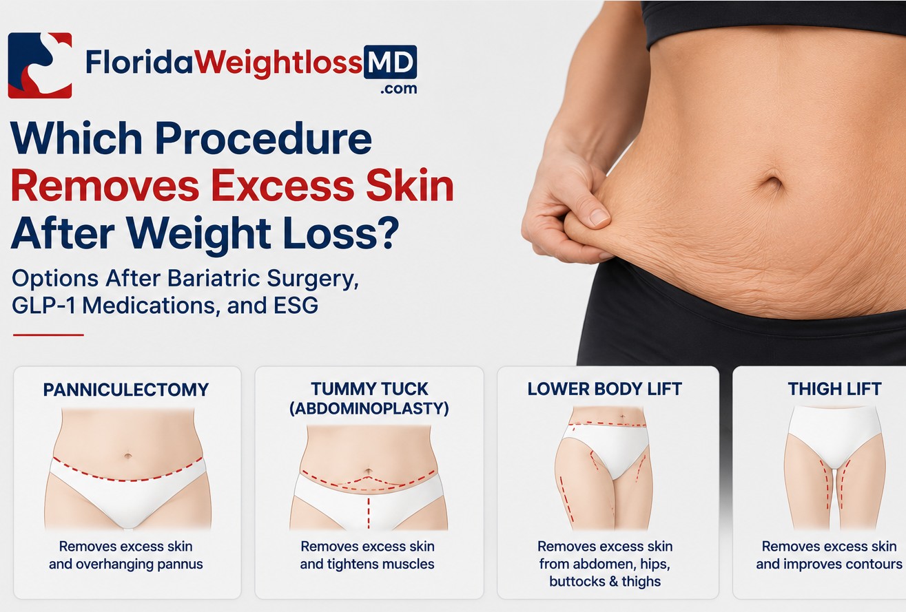 non-surgical procedures for abdomen contours after weight loss glp-1 Excess Skin Removal Following Bariatric Surgery, ESG, and GLP-1 Therapy-  Florida Surgery & Weight Loss Center