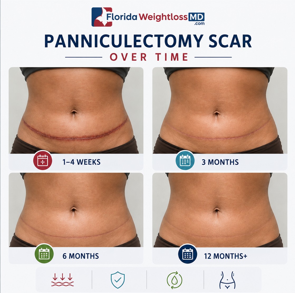 Panniculectomy scar healing timeline after excess skin removal showing scar changes from 1 to 4 weeks through 12 months