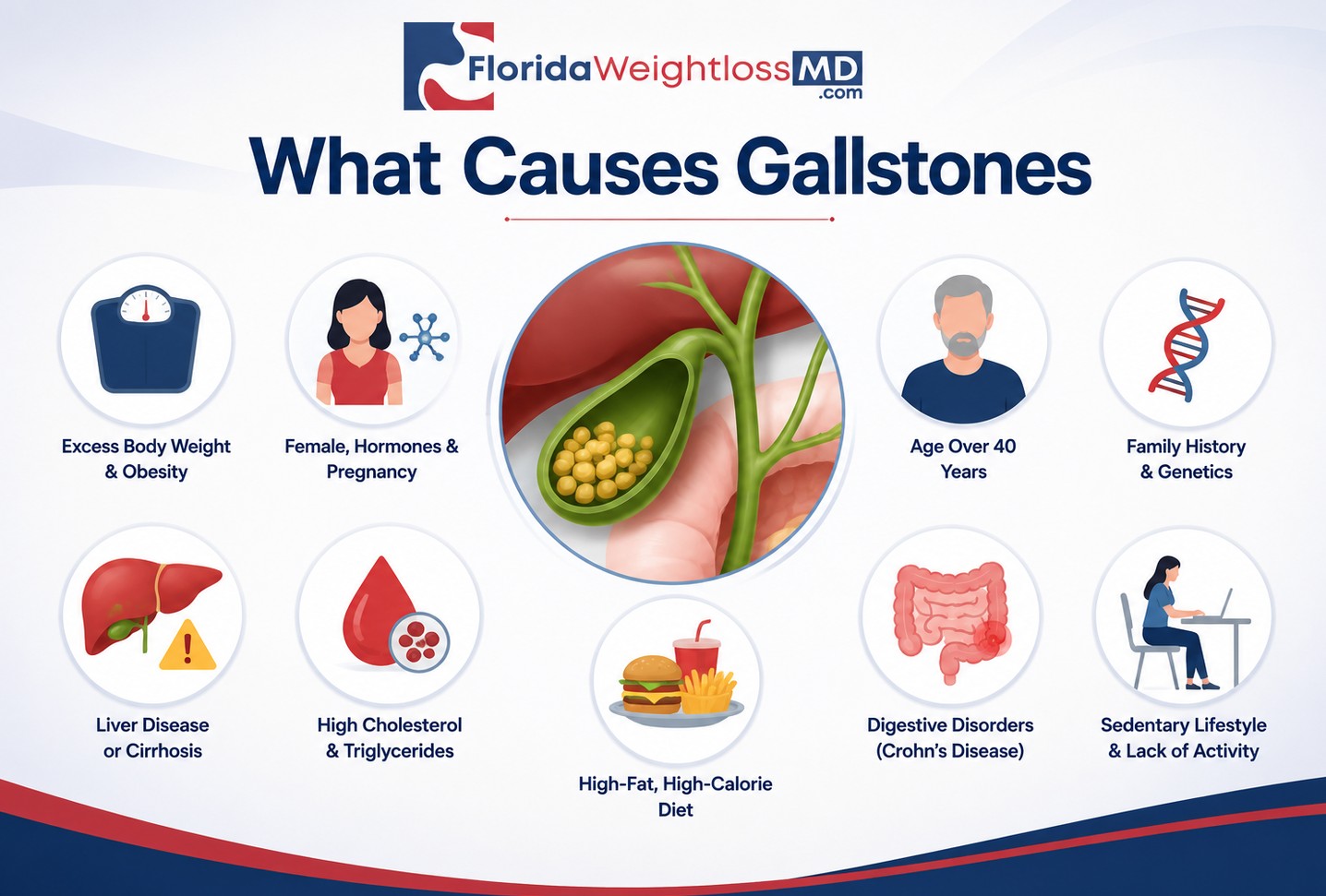 What causes gallstones infographic showing common risk factors including obesity, pregnancy, age, family history, high cholesterol, diet and digestive conditions.