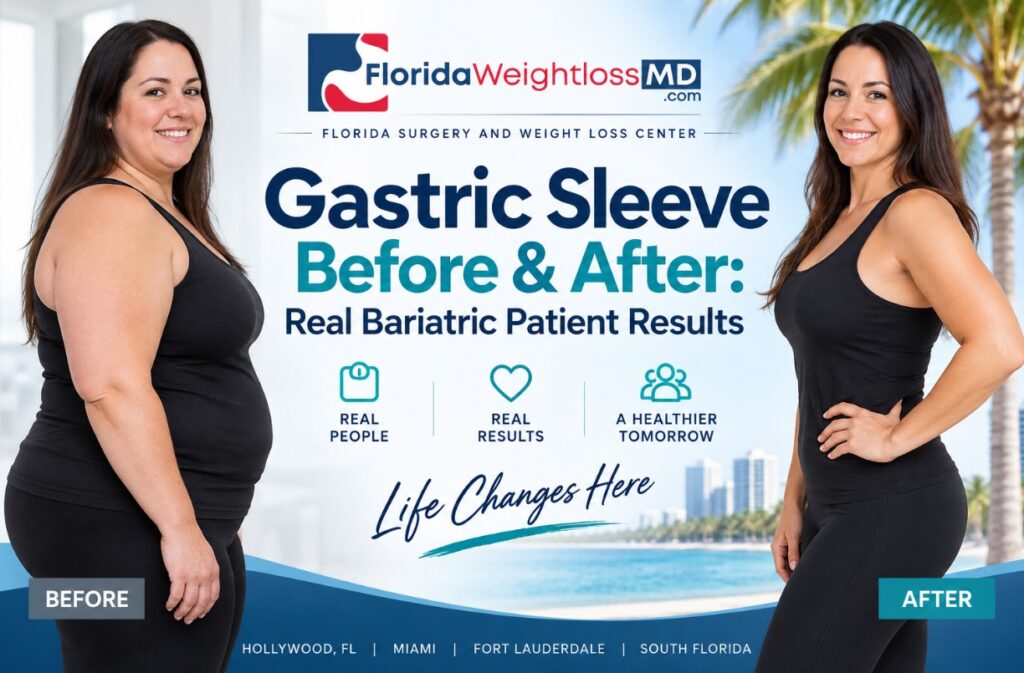Gastric sleeve before and after real bariatric patient results at Florida Surgery & Weight Loss Center.