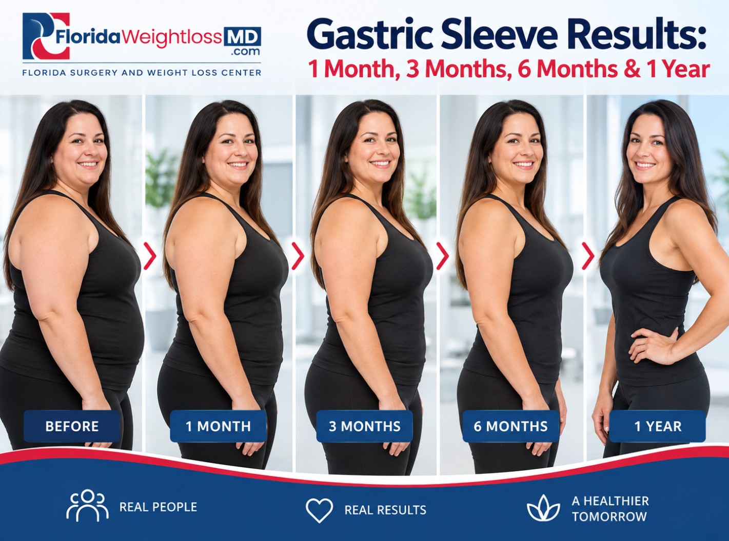 Gastric sleeve results timeline from 1 month to 1 year after bariatric surgery