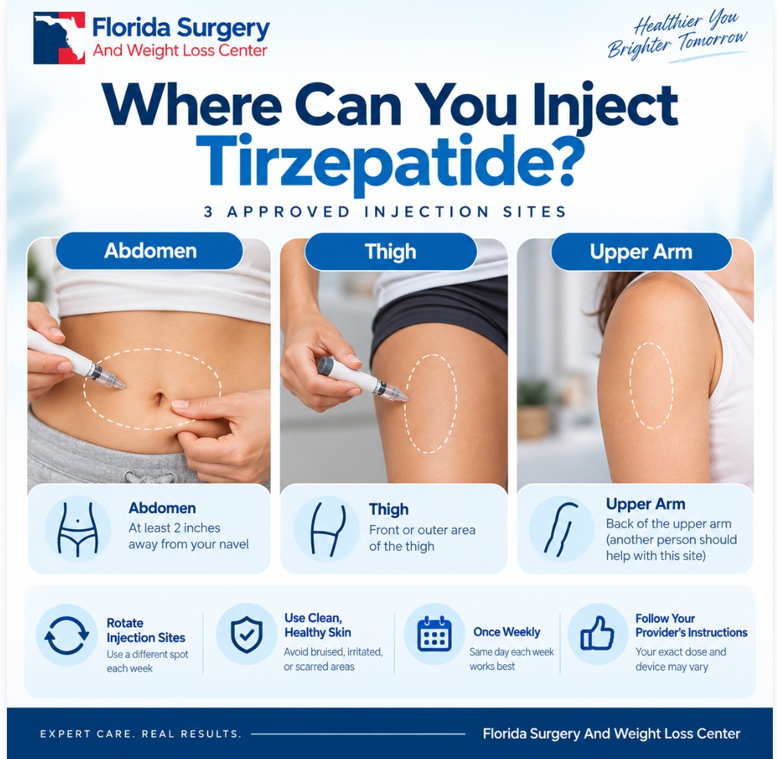 Where can you inject tirzepatide? Abdomen, thigh and upper arm injection sites – Florida Surgery And Weight Loss Center